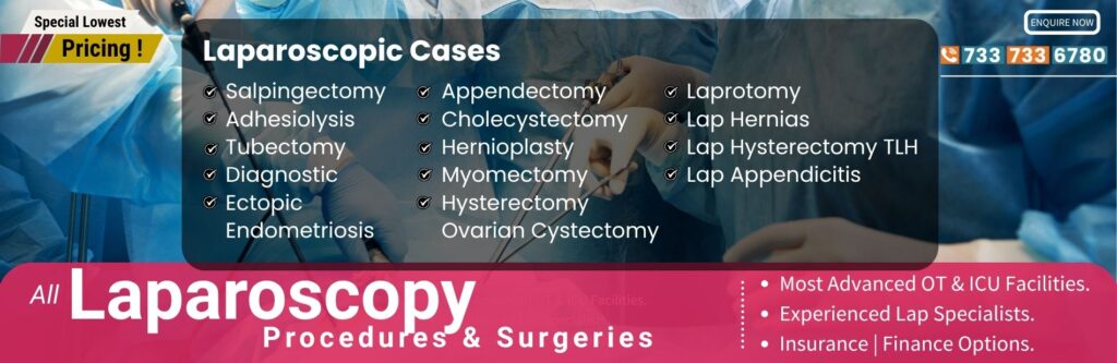 All Laparoscopy procedures & Surgeries in Hyderabad